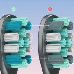 Periuta de dinti electrica cu vibratii AENO ADB0010G, 5 W, DuPont™, Timer, 5 moduri, 90 de zile cu o singura incarcare, Gri