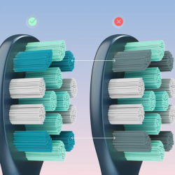 Periuta de dinti electrica cu vibratii AENO ADB0010N, 5 W, DuPont™, Timer, 5 moduri, 90 de zile cu o singuraincarcare, Albastru