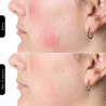 Masca fototerapeutica pentru fata Silk'n LED Face Mask 100 FLM100PE1001, Аutonomie de 130 de minute, 4 moduri, Sesiune de 10 minute, Design flexibil, Alb